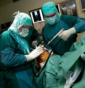 Knee arthroplasty surgery by RPA Janssen M.D.