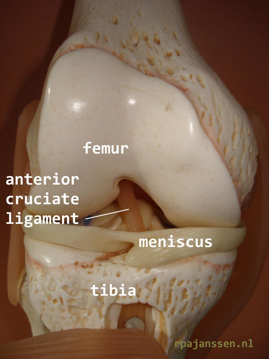 Frontal view of the knee with anterior cruciate ligament (also shown femur, meniscus and tibia)
